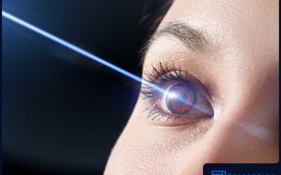 Key Things to Know Before Getting LASIK
