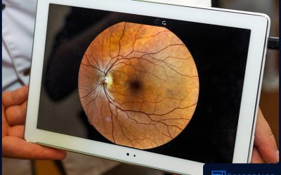 Essential Facts About Optos High-Resolution Retinal Imaging